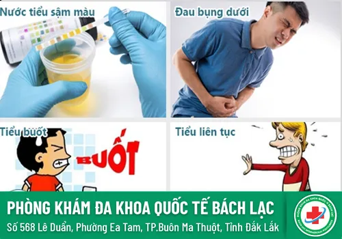 Tiểu đau tiểu ra máu là cảnh báo bệnh gì?