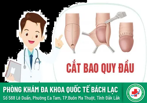 Cắt bao quy đầu ở Hoàng Mai Hà Nội - CẮT BAO QUY ĐẦU Ở ĐÂY