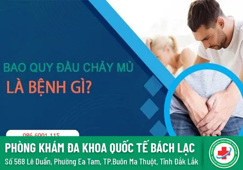 chay mu bao quy dau