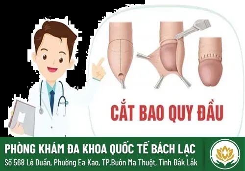 Cắt bao quy đầu ở Hoàng Mai Hà Nội - CẮT BAO QUY ĐẦU Ở ĐÂY