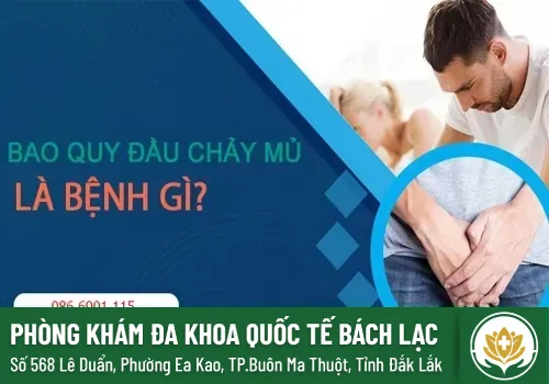 chay mu bao quy dau